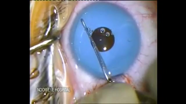 هرکی رنگ چشمشو دوست نداره می ت...