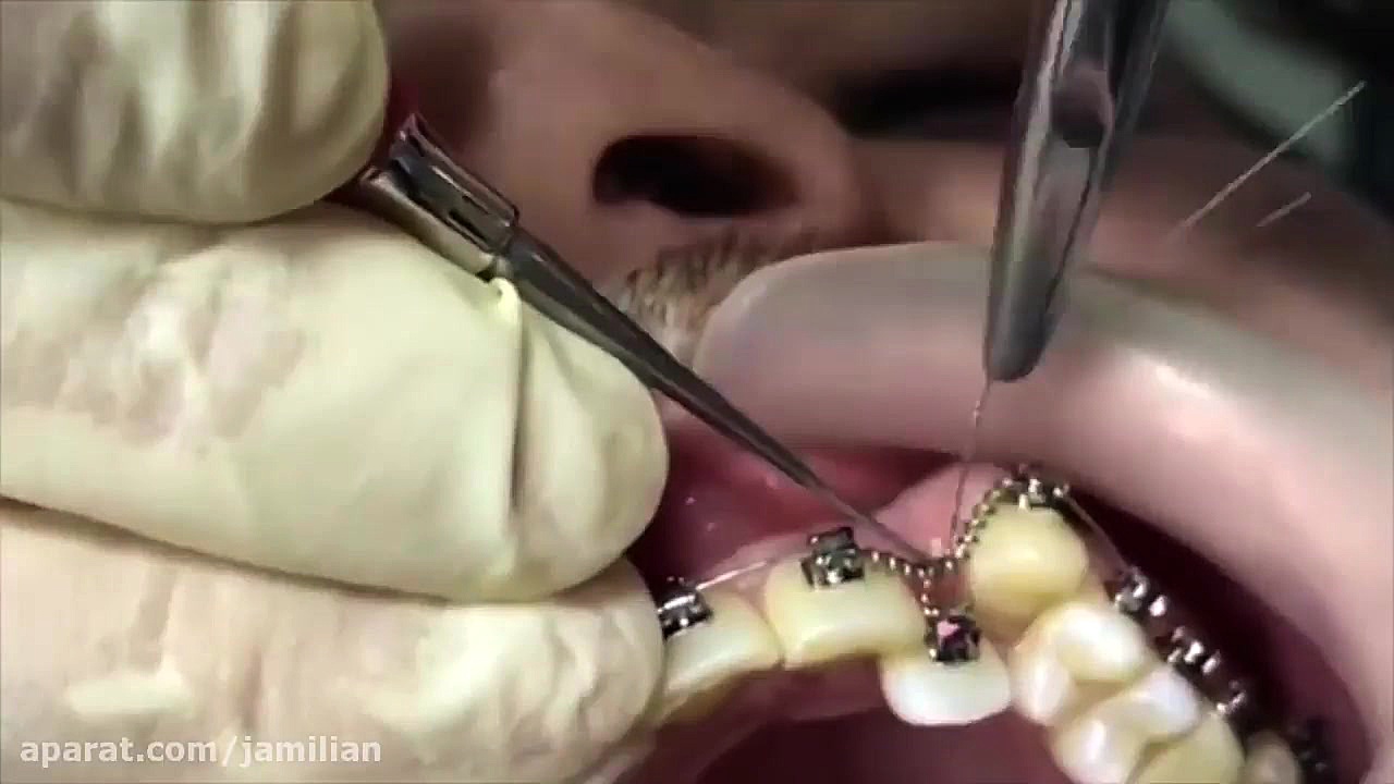 معجره ارتودنسی