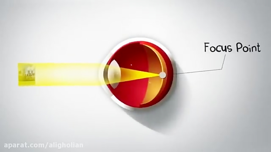 What is Astigmatism? / آستیگماتیسم چیست
