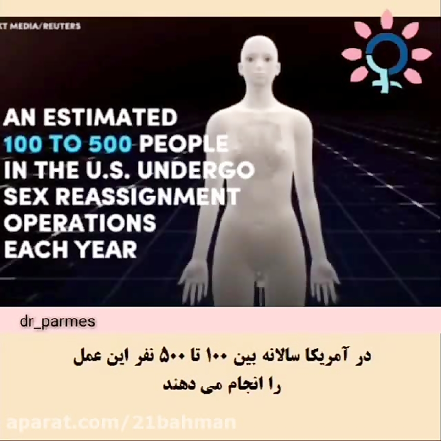 چگونگی تغییر جنسیت از زن به مرد