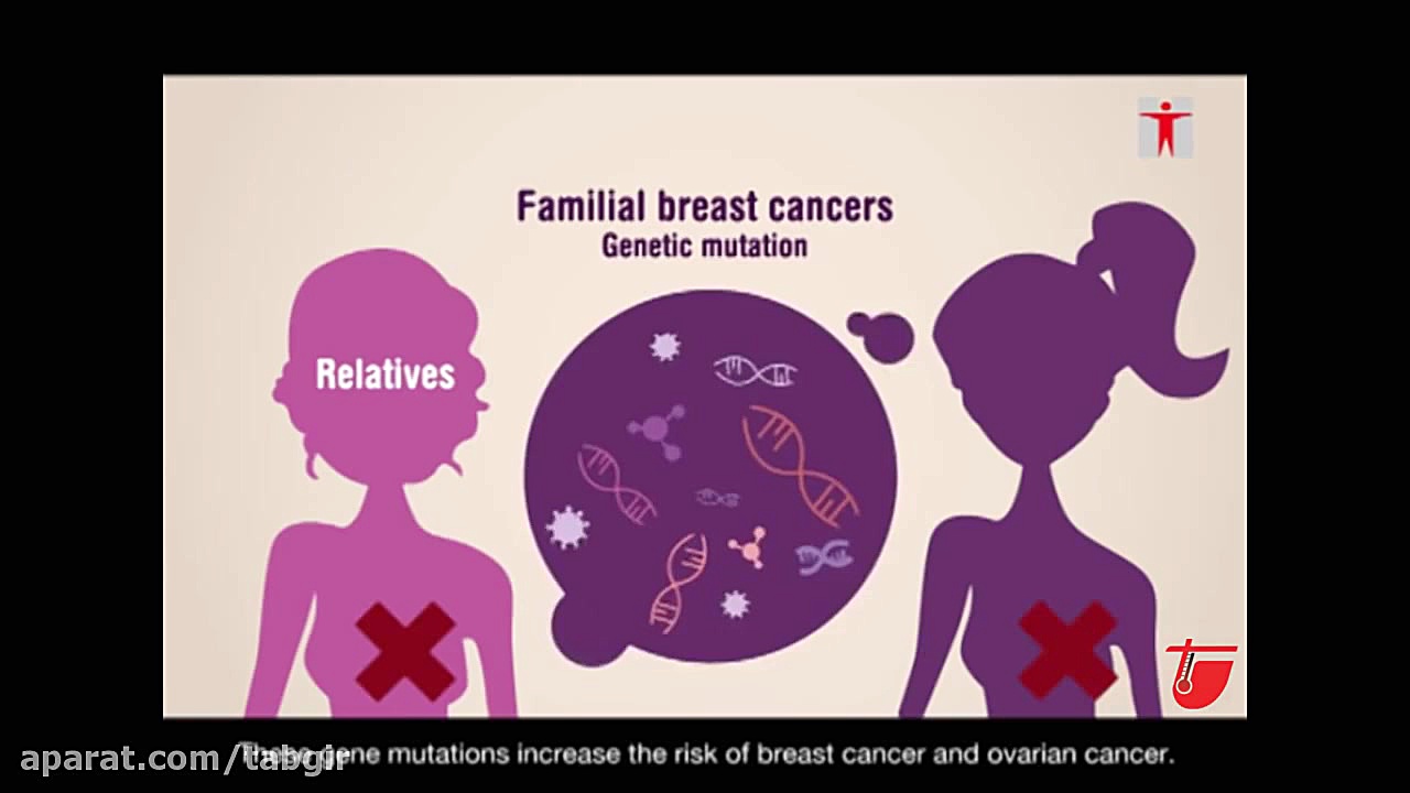 دانستنی های سرطان پستان و پیشگ...