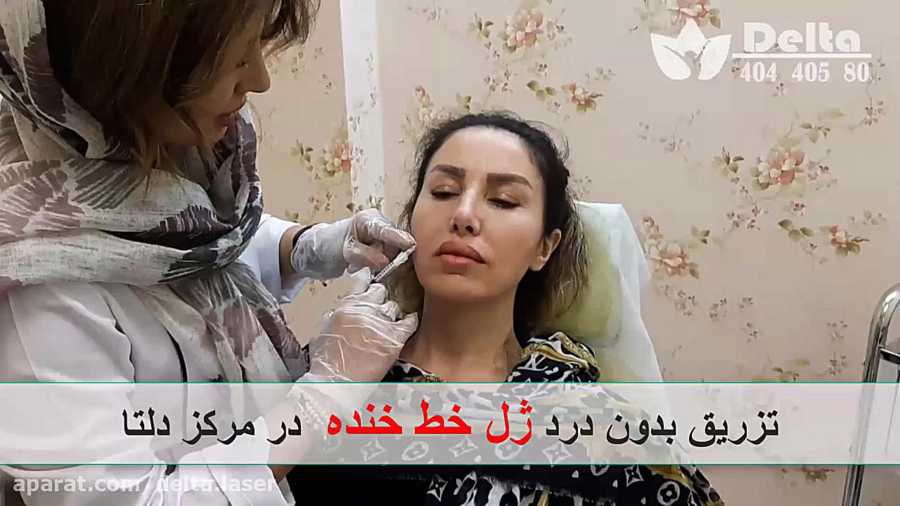فیلم تزریق ژل خط خنده در مرکز...