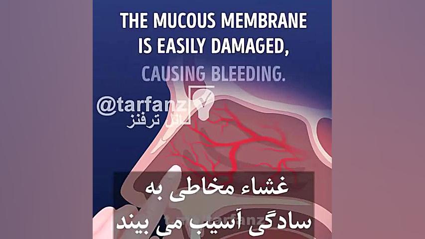 چرا نباید انگشت در بینی کرد.