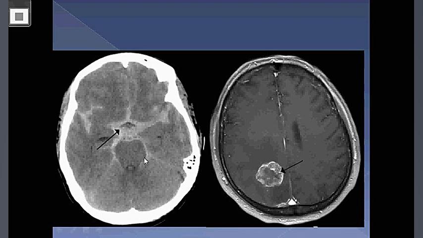 کودکان اعصاب دکتر رضایی 1