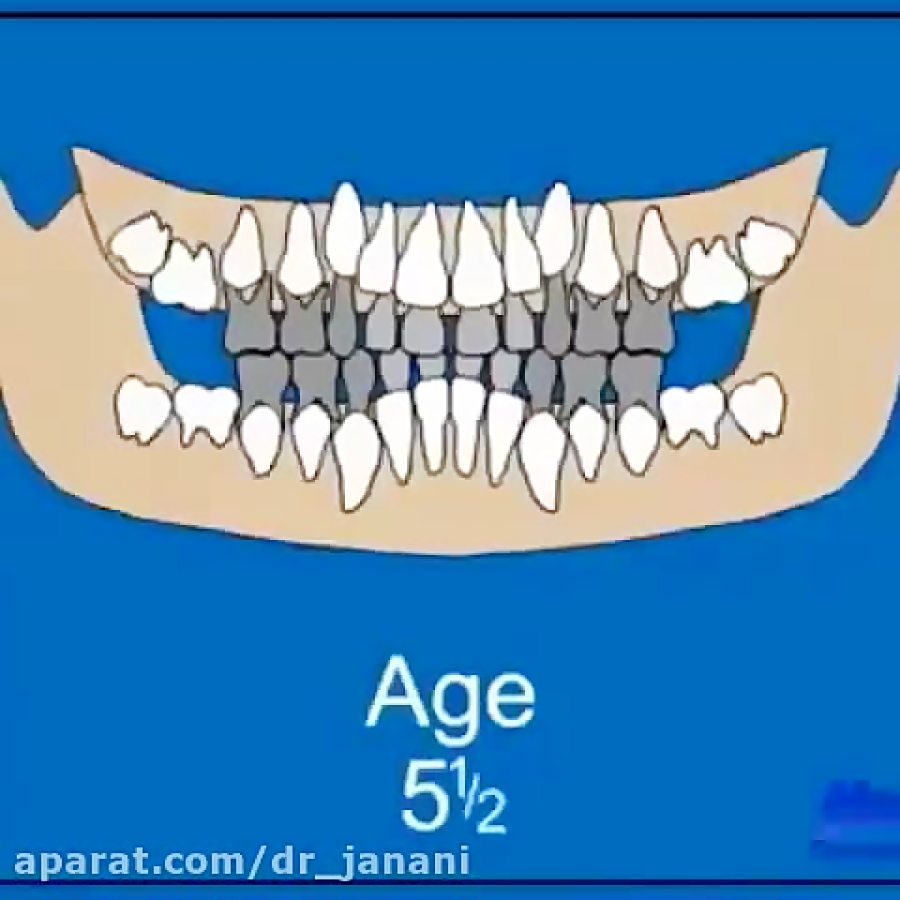 красивые зубки у детей. смена прикуса у детей. красивые детские зубы.