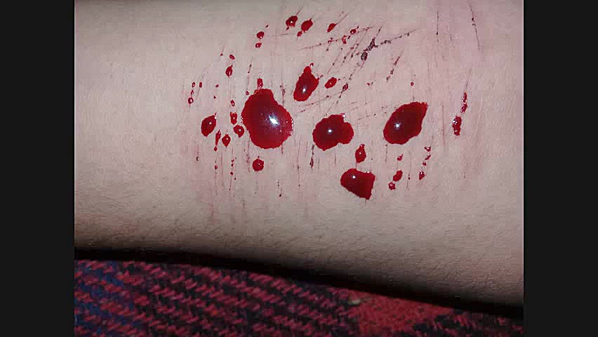 زخمی از عشق