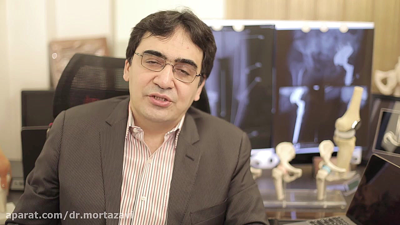 زانوی پرانتزی بدون جراحی