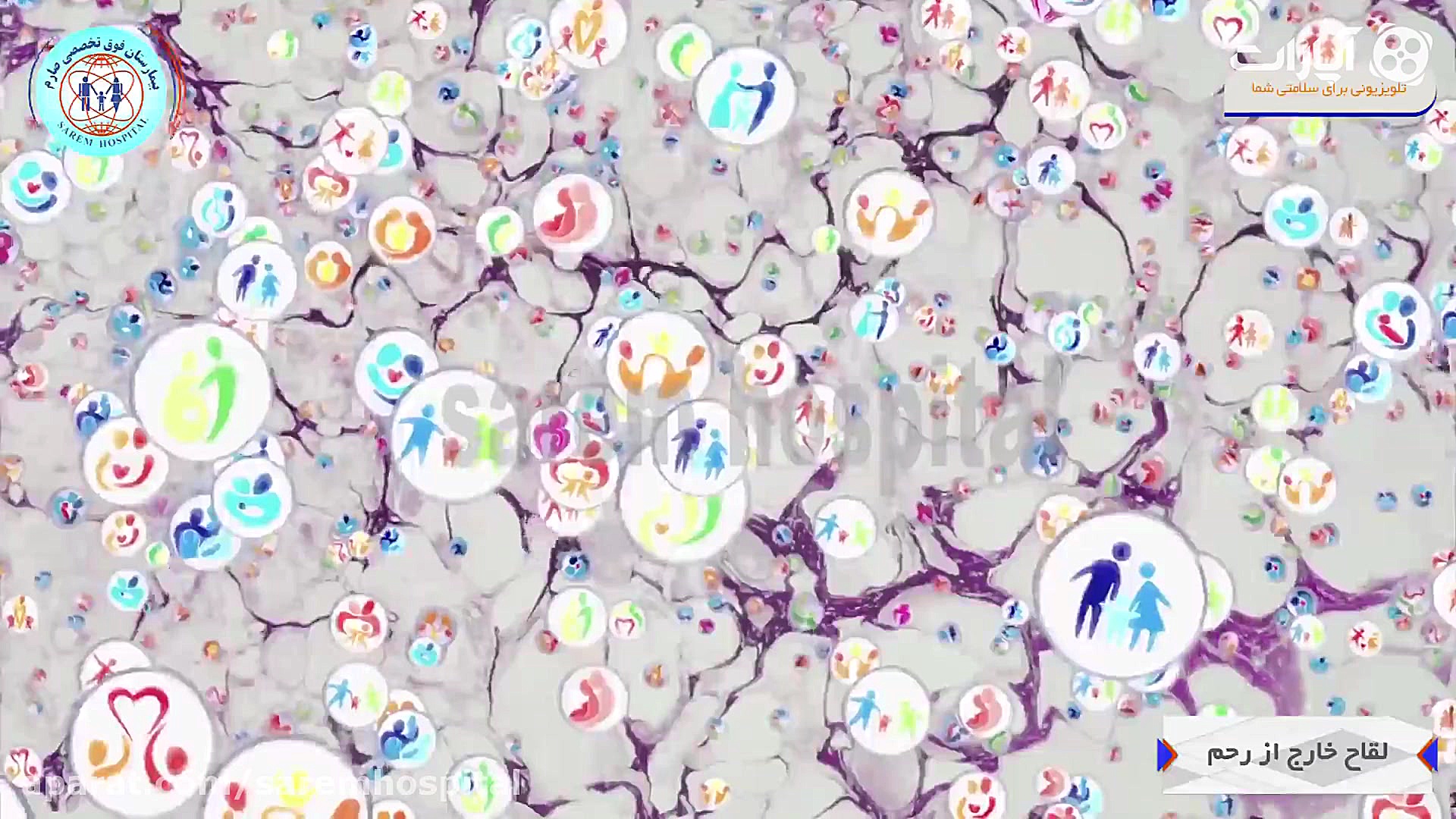 لقاح مصنوعی و آزمایشگاهی و IVF