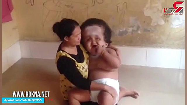 به دنیا آمدن نوزاد عجیب بچه غو...