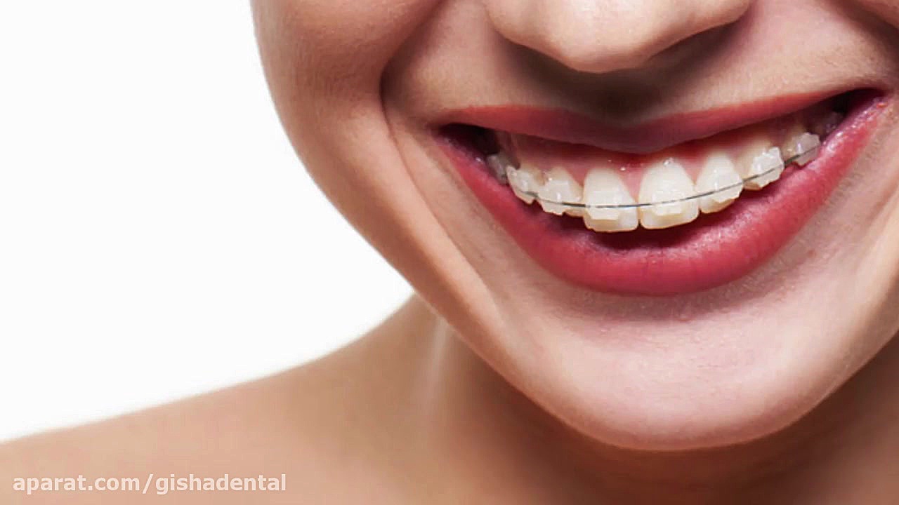 ارتوپدی فک توسط متخصص ارتودنسی