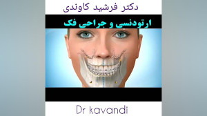 ارتودنسی و جراحی فک
