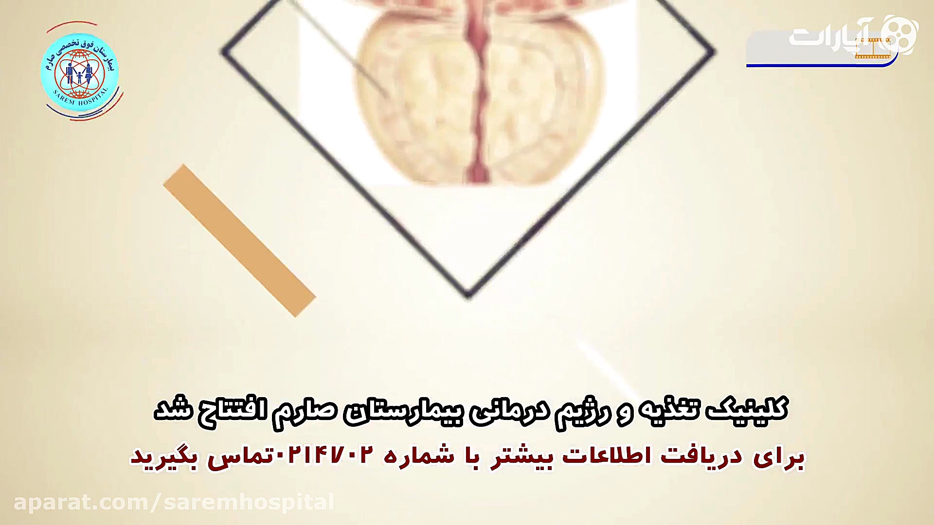 با رعایت این نکات از بروز سرطا...