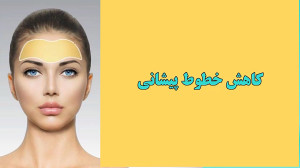هایفو برای جوانسازی پوست