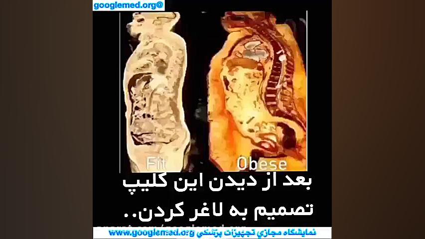 لاغری یا چاقی