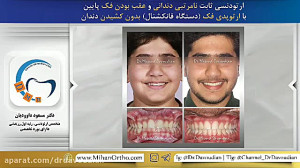 ارتودنسی نامرتبی دندانی و عقب...