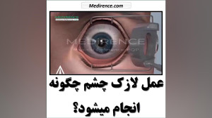 لازک | مهندسی پزشکی  تجهیزات پ...