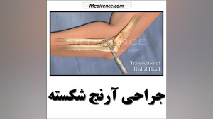 آرنج | مهندسی پزشکی  تجهیزات پ...