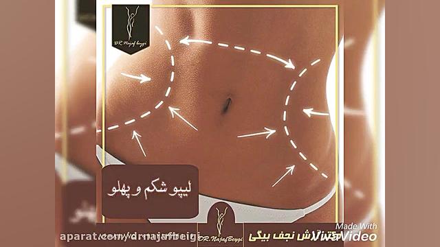 لاغری شکم و پهلو