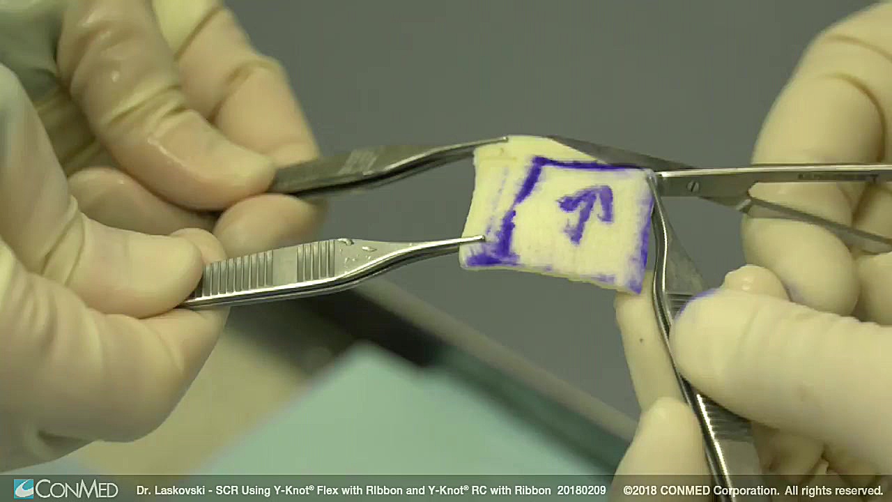  SCR Using Y Knot&reg; Flex w...