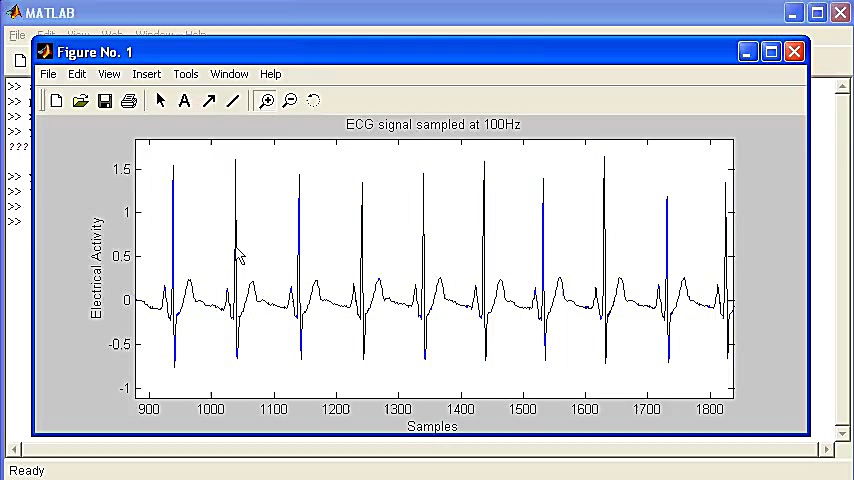 Signal Analysis using Matlab - A Heart Rate example