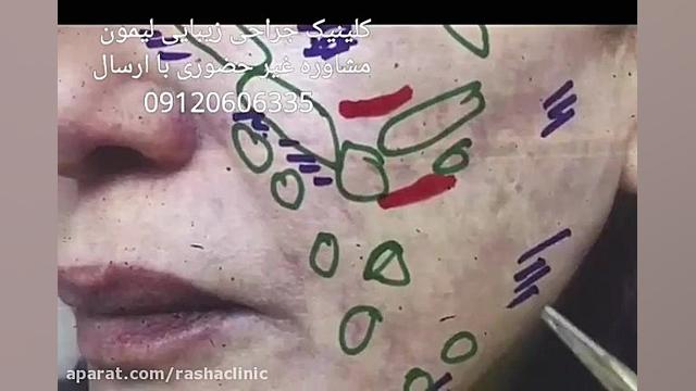 سونوگرافی صورت و اهمیت تشخیص م...