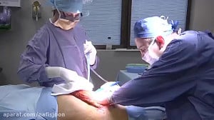 جراحی لاغری و زیبایی شکم و پهل...