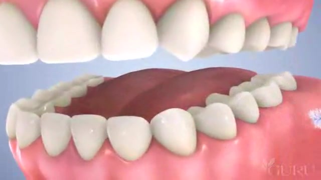براشینگ دندانپزشك كودكان مركز...