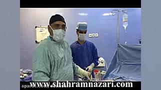 عمل بای پاس معده بدنبال شکست پ...