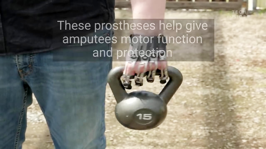 These Prostheses Help Give Amputees Motor Function and Protection