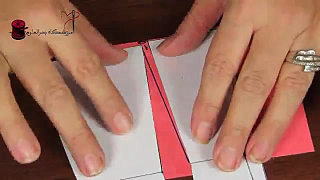 رفع ایراد اندامی باسن برجسته آ...