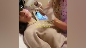 بهترین دستگاه لیزر الکساندرایت