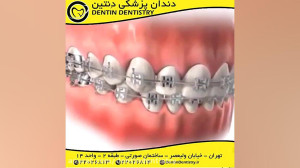 شیوه صحیح استفاده از مسواک و ن...