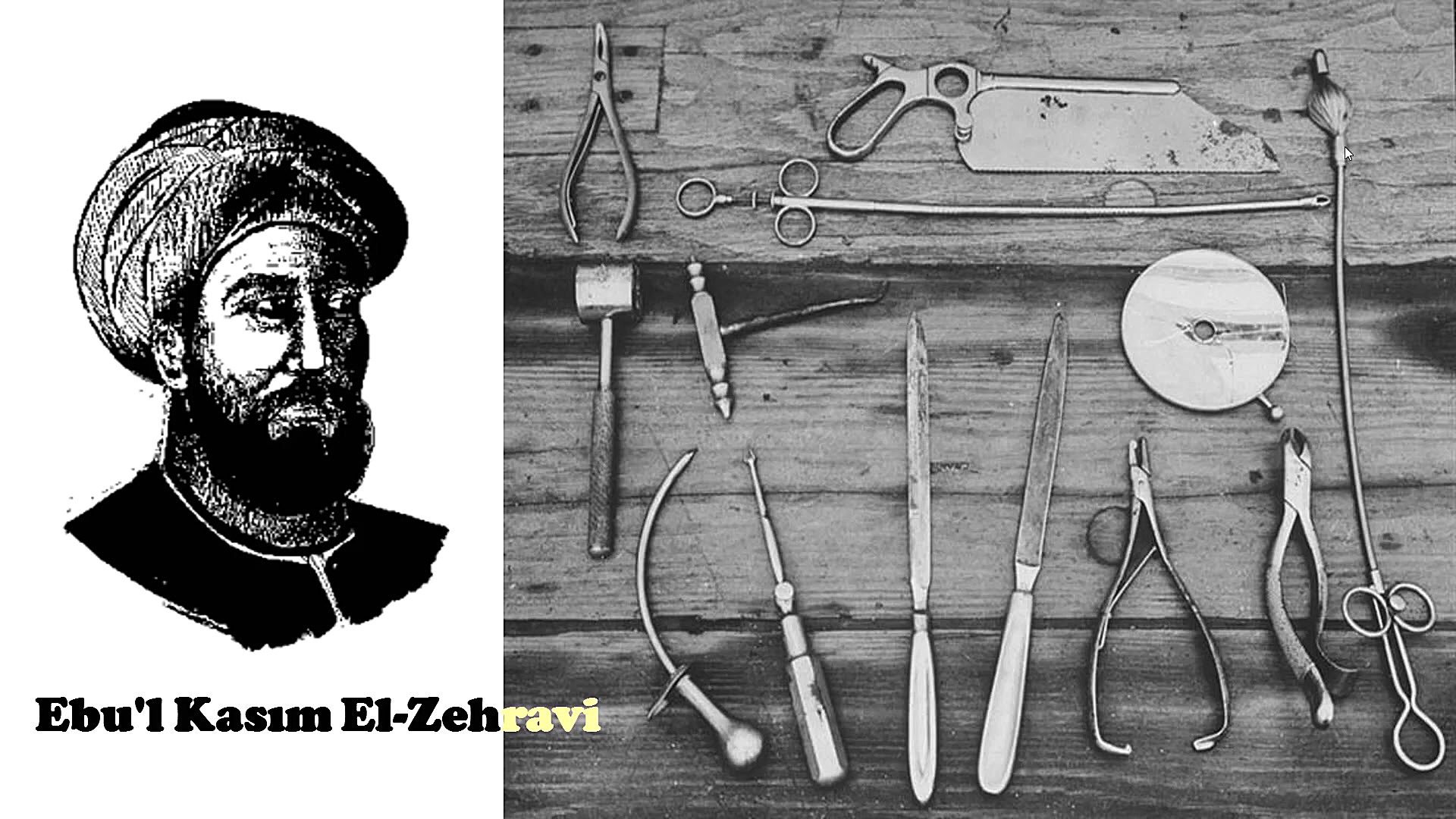 چرا x نماد مجهول در ریاضی است