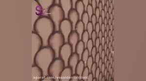 نقش تغذیه بر روی سلامت دندان ه...
