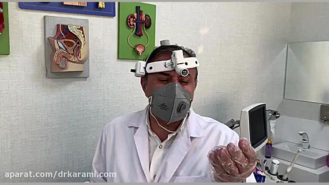 درمان زگیل های تناسلی بزرگ با...