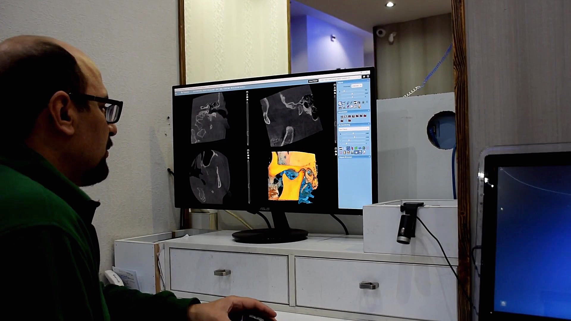 بررسی TMJ با CBCT