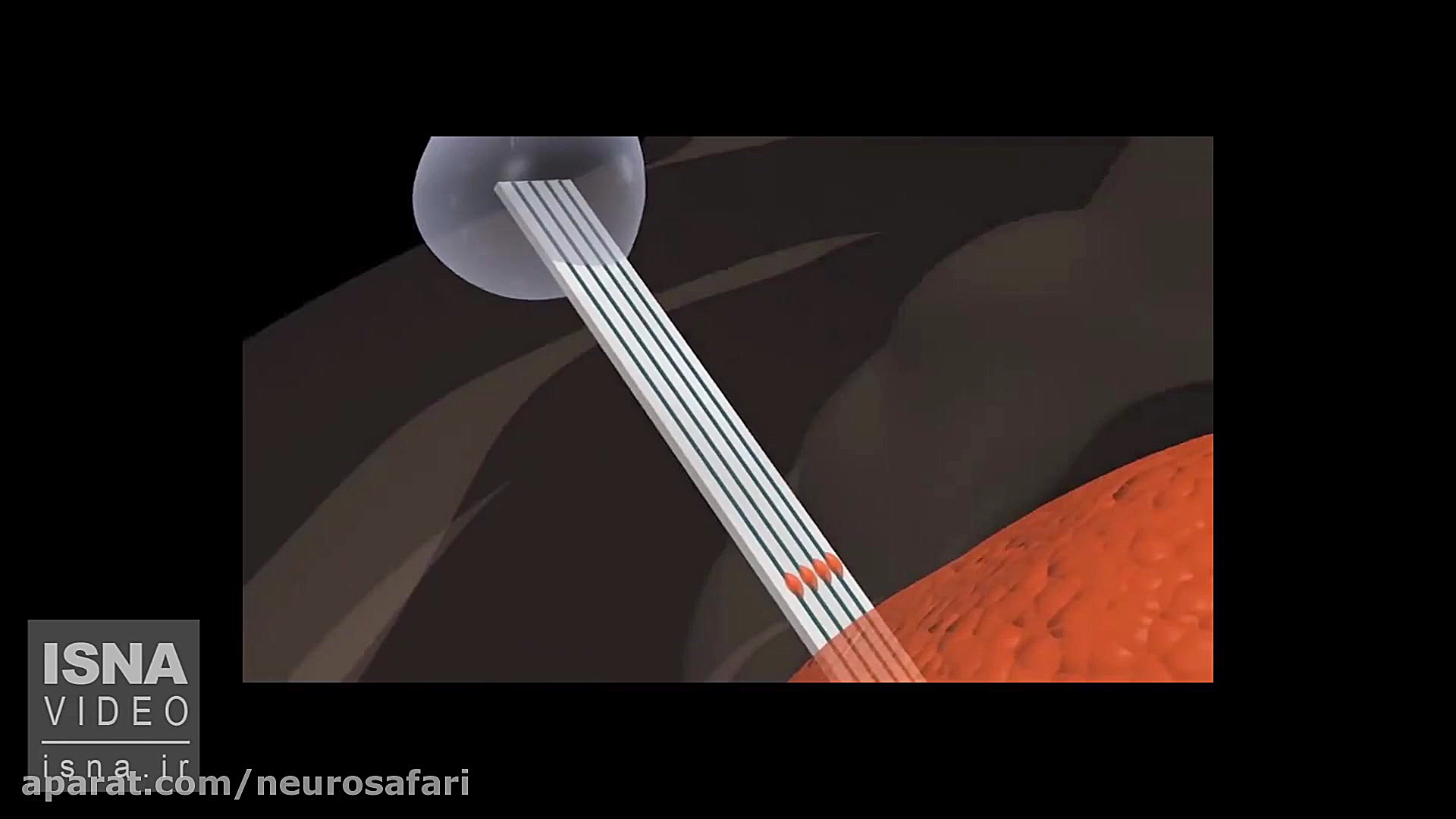 استفاده از &quot;مونوریل تومور...