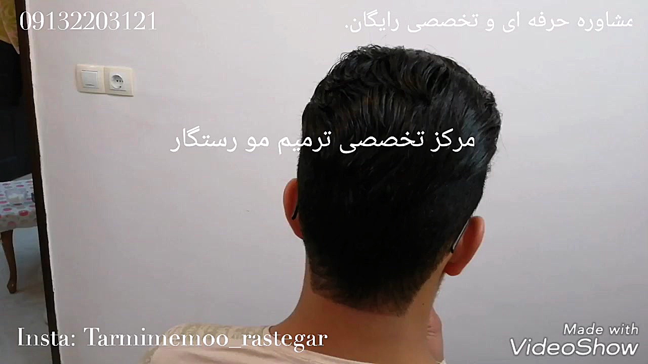 ترمیم مو طبیعی اقایان(پروتز مو...