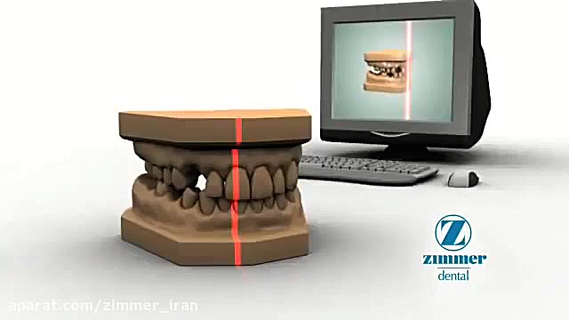 Zimmer Biomet CadCam Abutment