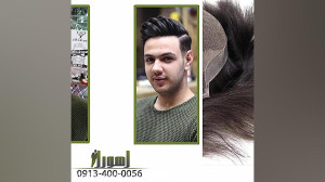 پروتز مو ترمیم مو