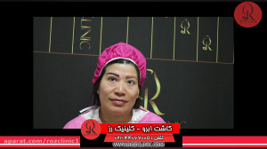 کاشت ابرو | فیلم کاشت ابرو | ک...