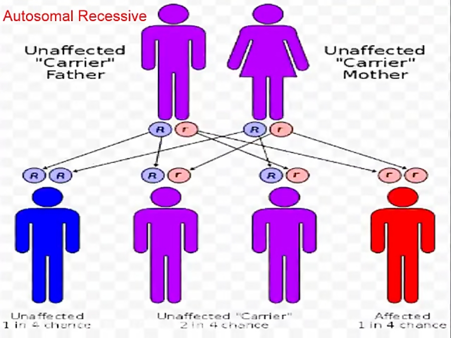 Giant Axonal Neuropathy