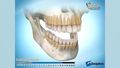 رویش دندان های شیری و اصلی  دک...