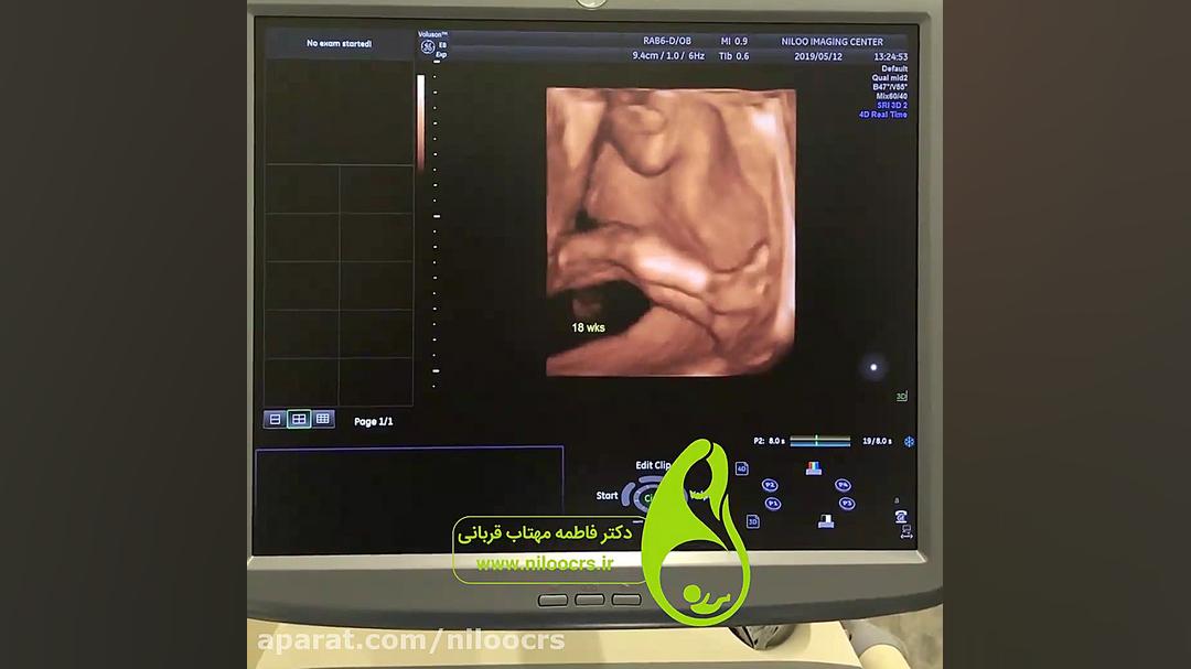 جنین و آب بازی