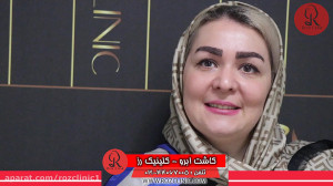 کاشت ابرو | فیلم کاشت ابرو | ک...