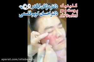 میکرونیدلینگ طبیعی ترین روش جو...