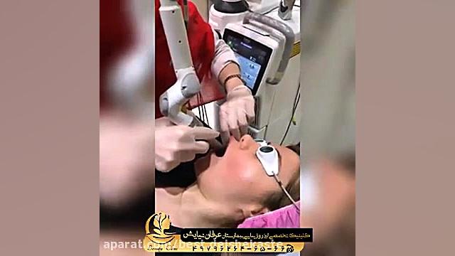 فیلم جوانسازی پوست