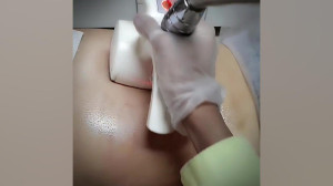 لاغری موضعی و کاهش سایز شکم و...