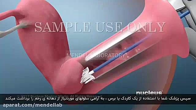 راهنمای آزمایش پاپ اسمیر و HPV
