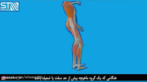 راه های پیشگیری از کمردرد